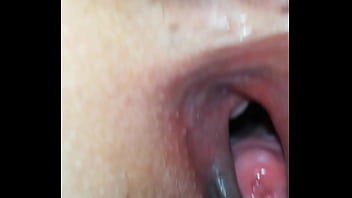 Histeroscopia de boceta larga