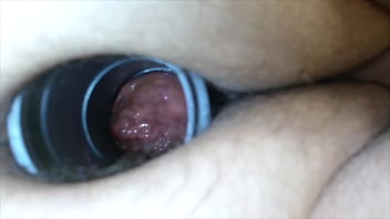 Prolapso de plugue anal oco cuteandcool1