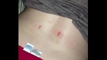 s. woman hickey on back cum shot