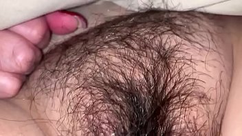 Very hairy vulva