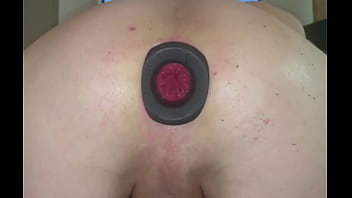 Watch my red prolapsed ass hole open and close