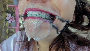 mouth tongue braces teeth by auro smith chaturbate.com